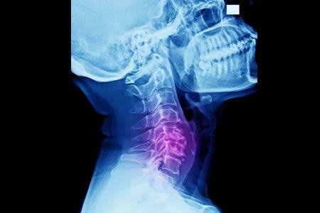 Anatomía neurológica cervical